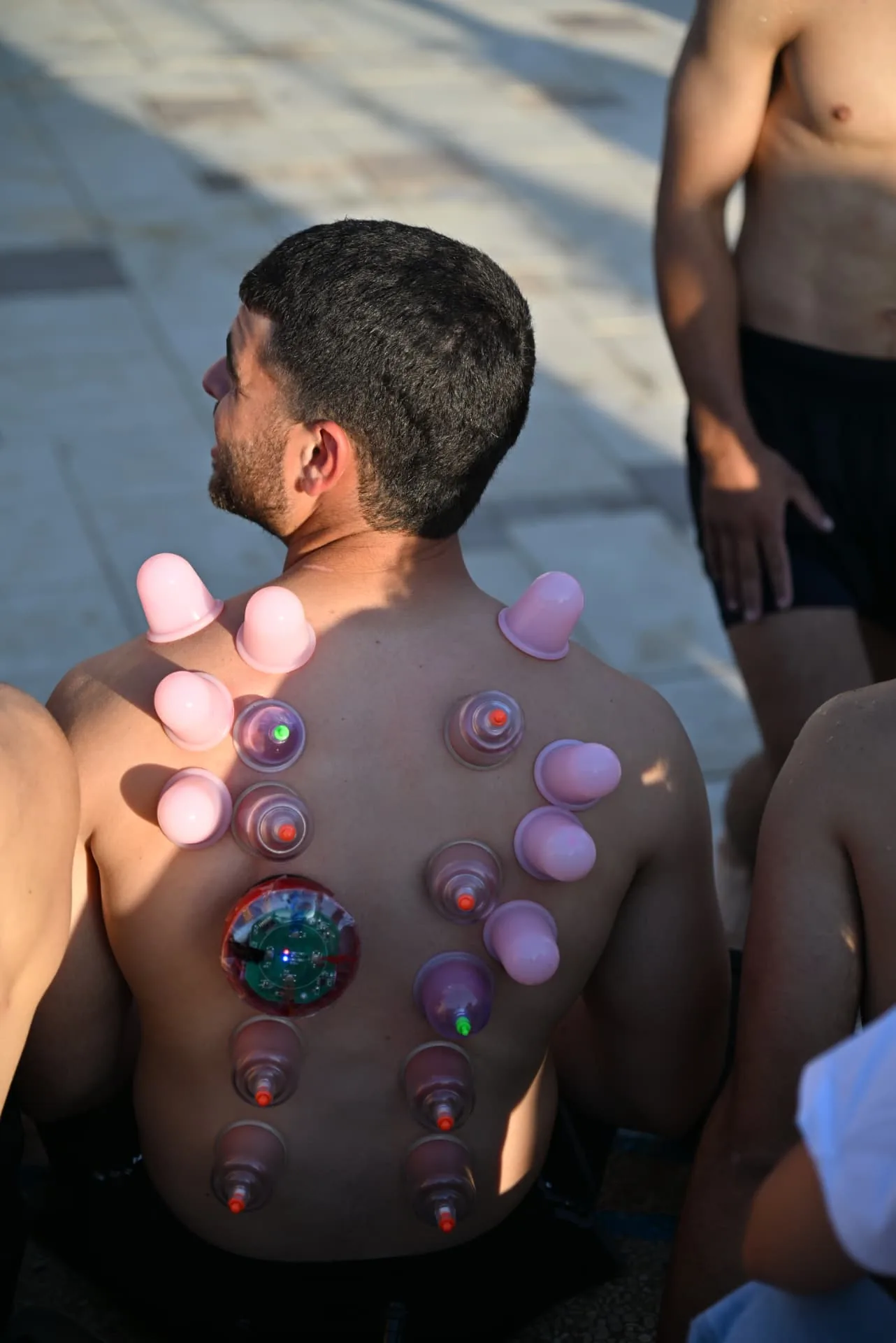 Soldier receiving cupping treatment outdoors